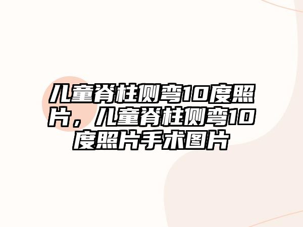 兒童脊柱側(cè)彎10度照片，兒童脊柱側(cè)彎10度照片手術(shù)圖片