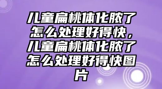 兒童扁桃體化膿了怎么處理好得快，兒童扁桃體化膿了怎么處理好得快圖片